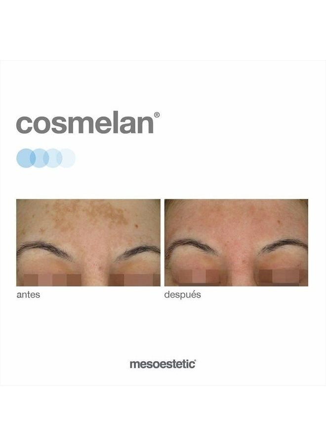 mesoestetic Cosmelan 2 Home Maintenance Treatment Cream for Melasma  - Image 4