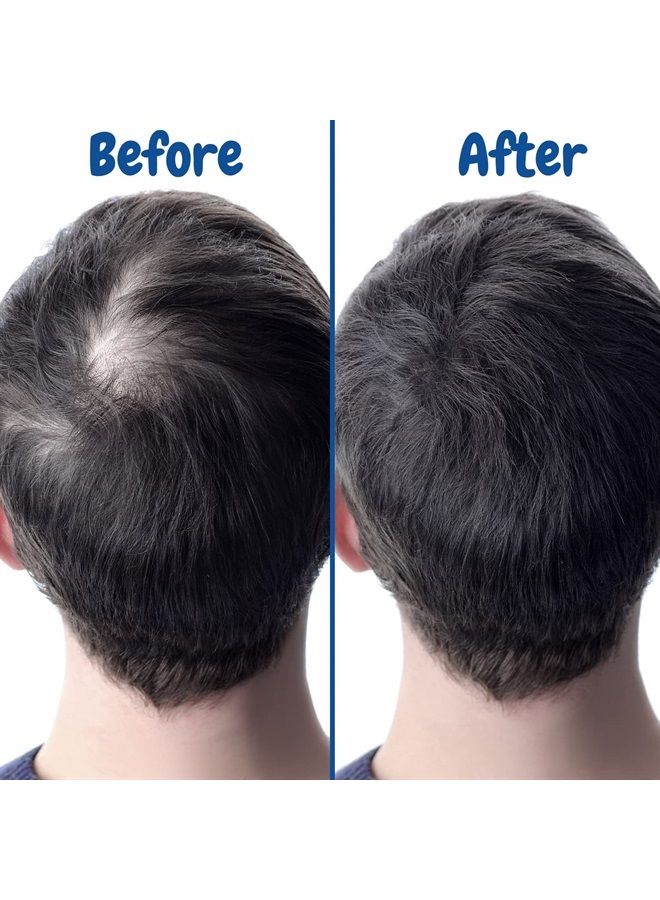 verseo Sup Hair & Best Hair Growth Conditioner Treatment | Conditioner for Thinning Hair and Hair Loss | Repairing Damaged Hair & Hair Loss | 28 Day Supply (Conditioner) - Image 2