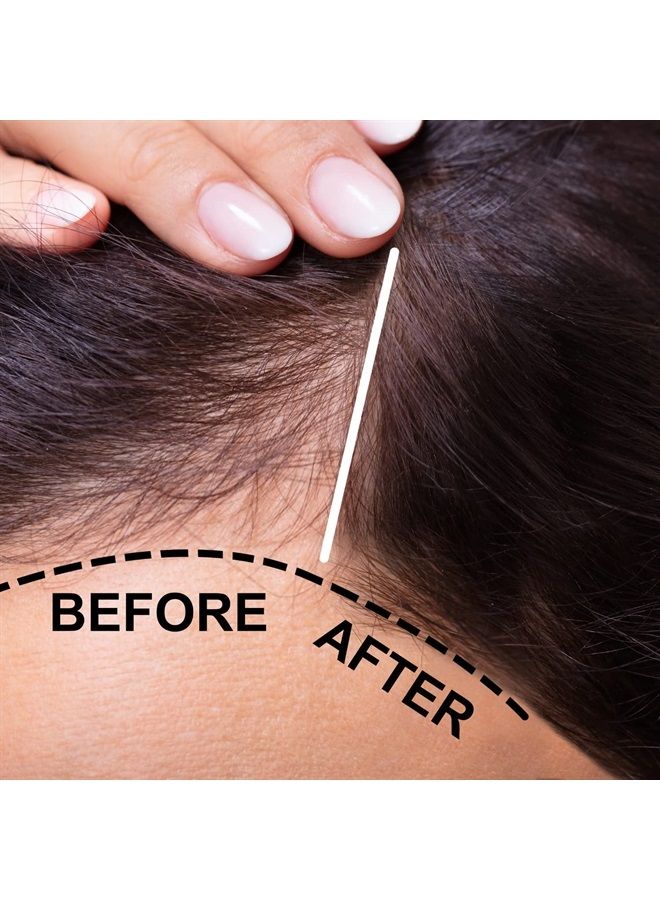verseo Sup Hair & Best Hair Growth Conditioner Treatment | Conditioner for Thinning Hair and Hair Loss | Repairing Damaged Hair & Hair Loss | 28 Day Supply (Conditioner) - Image 3