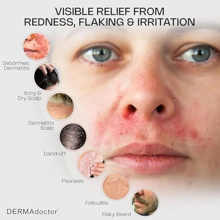 DERMAdoctor Seborrheic Dermatitis Face Wash – 2% Pyrithione Zinc Shampoo Dermatologist Formulated Dandruff Scalp Treatment – Pyrithione Zinc Face Wash and Body Cleanser for Sensitive Skin – 7.10 oz - Image 5