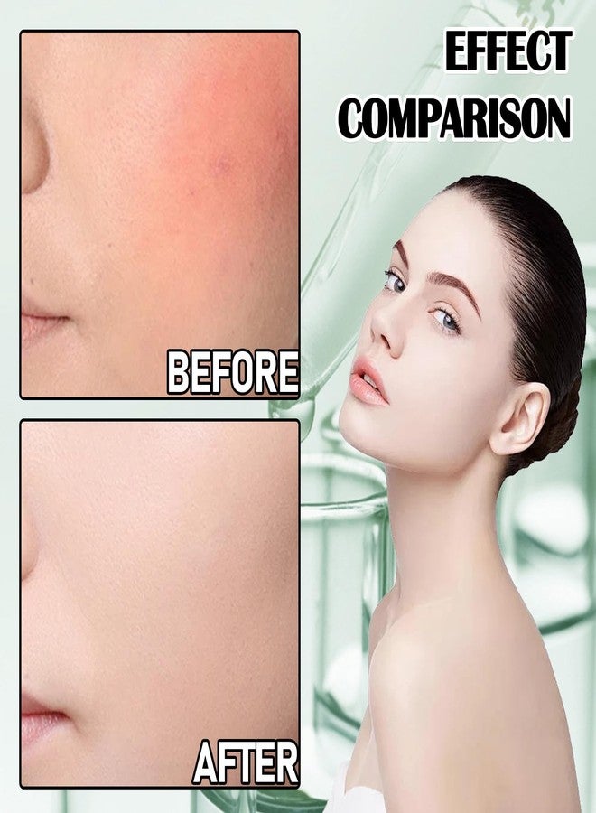 Fusang 8Pcs Organic Aloe Vera Gel for After Sun Skin Care,Natural Moisturizing Aloe Vera Gel for Face & Body,Easy to Portable Face Moisturizer,Travel Size Pure Vera Aloe Gel for all Skin Types - Image 3