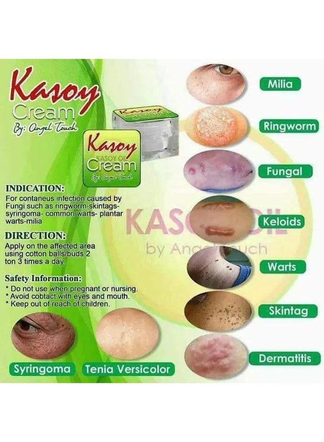 ANGEL TOUCH Kasoy Cream by Angel Touch — Explore a Traditional-Inspired Skin Care Cream Promoted for Multiple Common Skin Concerns, Including Fungal Problems, Ringworm, Milia, Warts, Skin Tags, and Other Uneven Skin Conditions. - Image 2