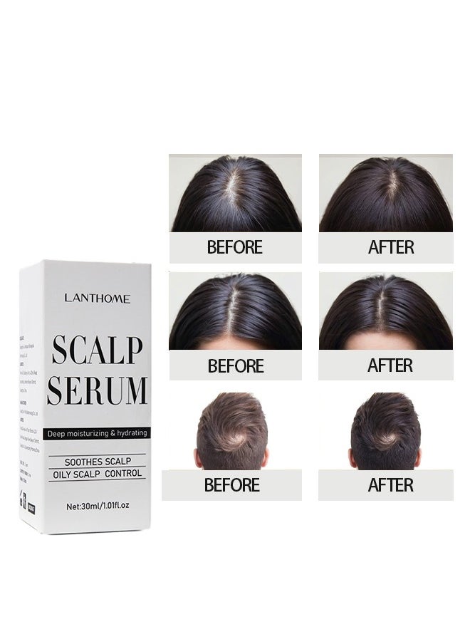 Lanthome Scalp Serum ,for Dry and Itchy Scalp - Promote Scalp Health - Clarifying Scalp Scrub for Healthier and Stronger Hair，Hair Regrowth Serum for Thinning Hair, Hair Loss, Frizzy and Damaged Hair 30ml  - Image 4