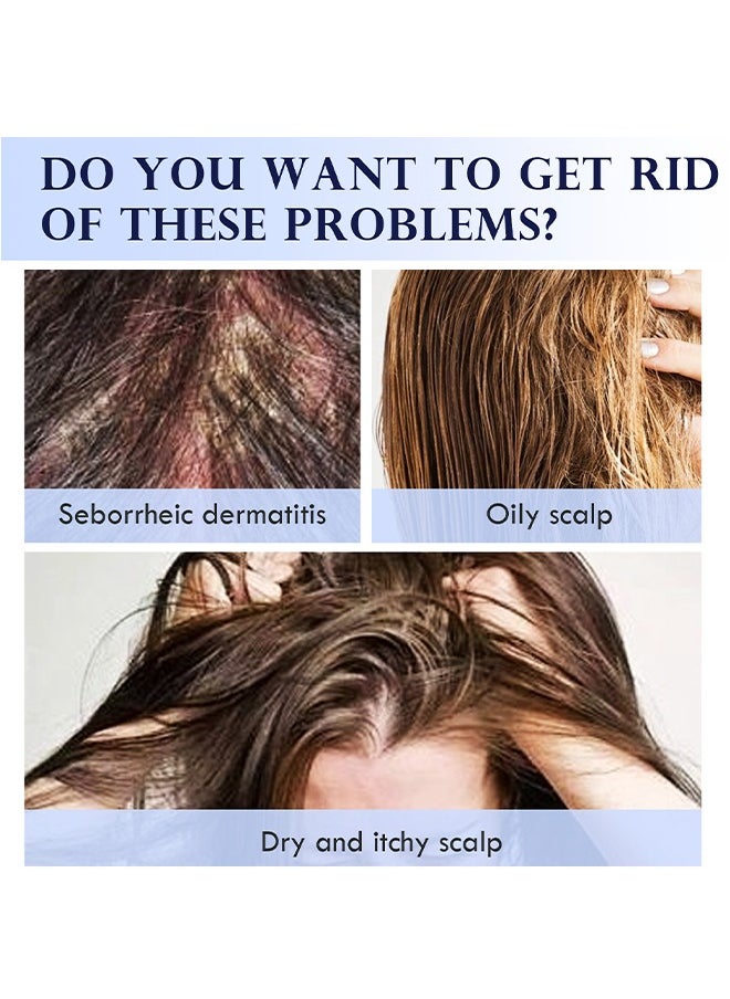 Lanthome Scalp Serum ,for Dry and Itchy Scalp - Promote Scalp Health - Clarifying Scalp Scrub for Healthier and Stronger Hair，Hair Regrowth Serum for Thinning Hair, Hair Loss, Frizzy and Damaged Hair 30ml  - Image 5