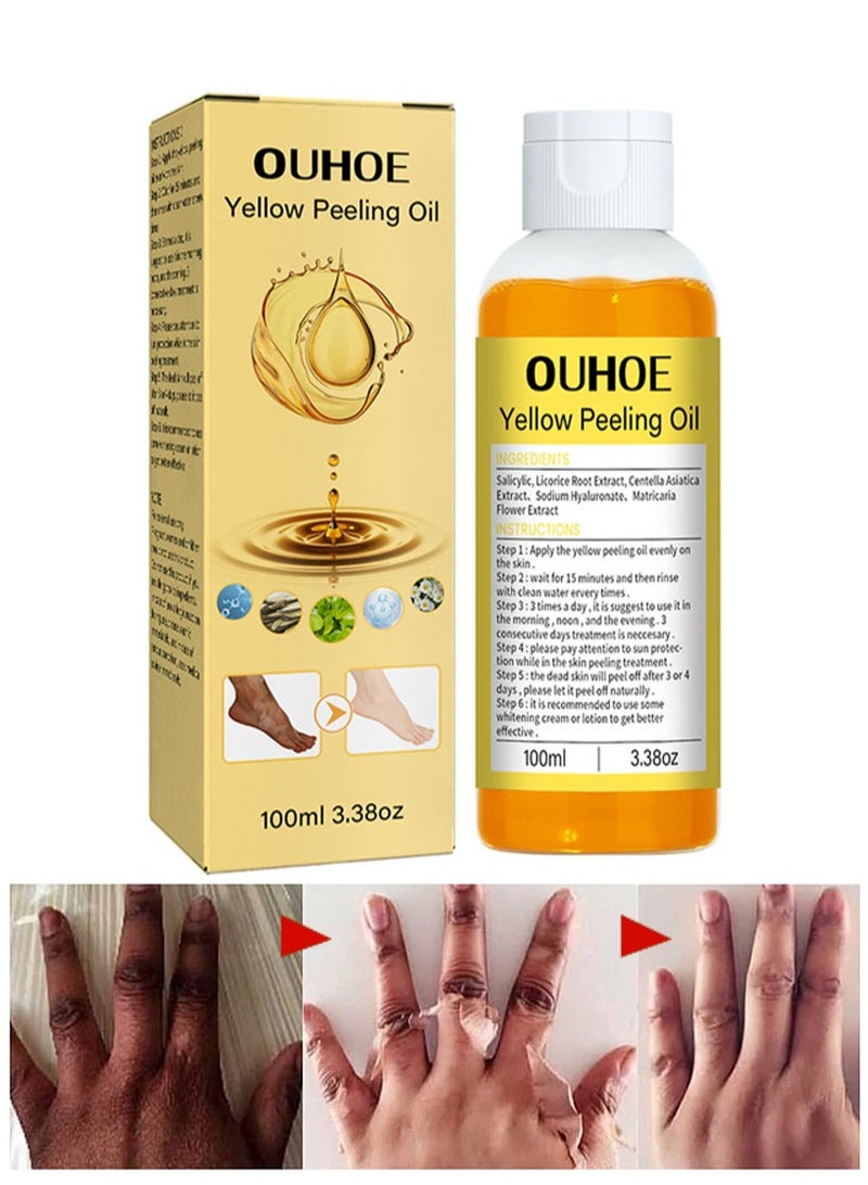 OUHOE Peeling Oil for Dark Skin, Peeling Solution with Salicylic Acid, Dark Spot Corrector for Body, Skin Brightening Peeling Solution for Dull Skin and Uneven Skin Tone for Glowing and Fresh Skin, 100ML - Image 1
