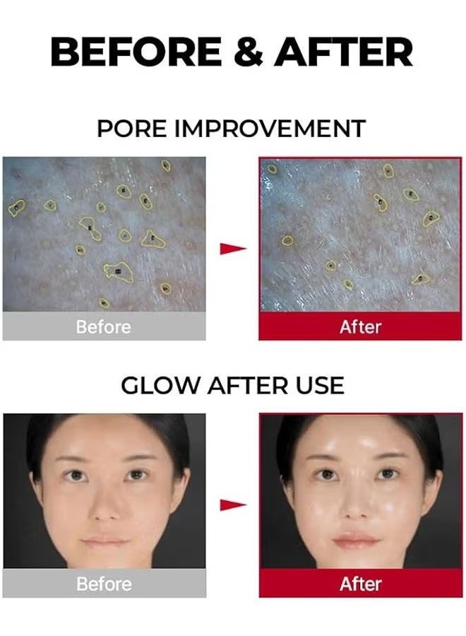 MEDIPEEL Collagen Wrapping Mask, 300Da Collagen, Pore Lifting, Pore Tightening, Glowy Skin, Skin Elasticity, Pore Lifting, Moisture Face Mask - Image 3