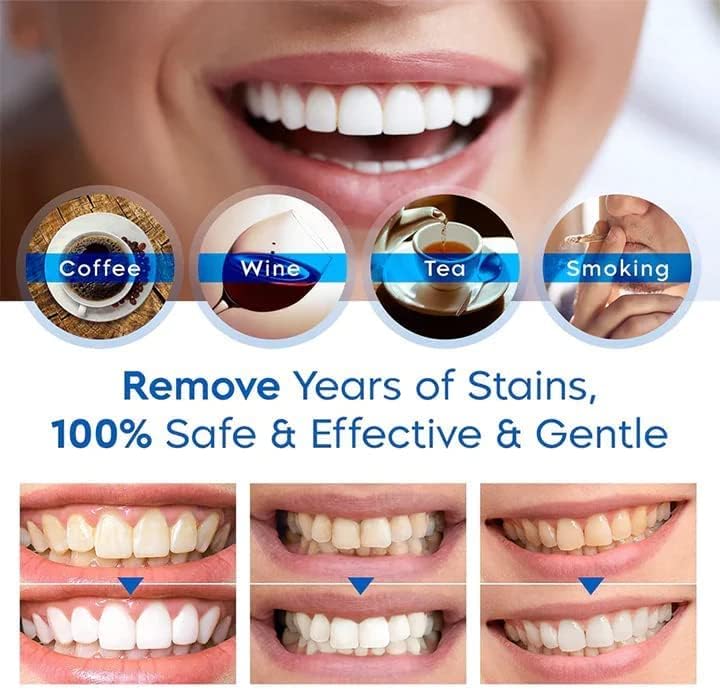 6/10PCS Lanthome Teeth Whitening Essence Pen, Teeth Whitening Essence, Lanthome Teeth Whitening Foam, Herbaluxy Teeth Whitening, Teeth Stain Remover to Whiten Teeth (6PCS) 6PCS - Image 2