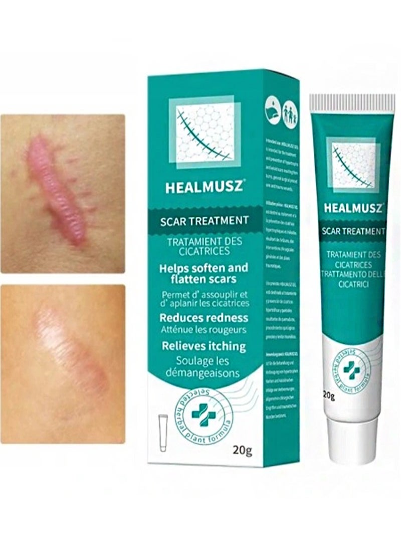 HEALMUSZ - Scar Treatment,Scar Cream,Lump Removal, Effective Scar Removal Cream for Acne Scars, Burn Scars, C-Section Scars, Stretch Marks and Surgical Scars - Image 1