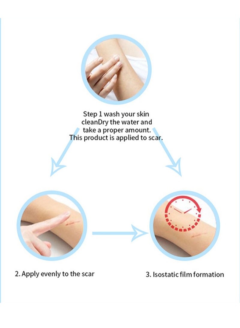 HEALMUSZ - Scar Treatment,Scar Cream,Lump Removal, Effective Scar Removal Cream for Acne Scars, Burn Scars, C-Section Scars, Stretch Marks and Surgical Scars - Image 1