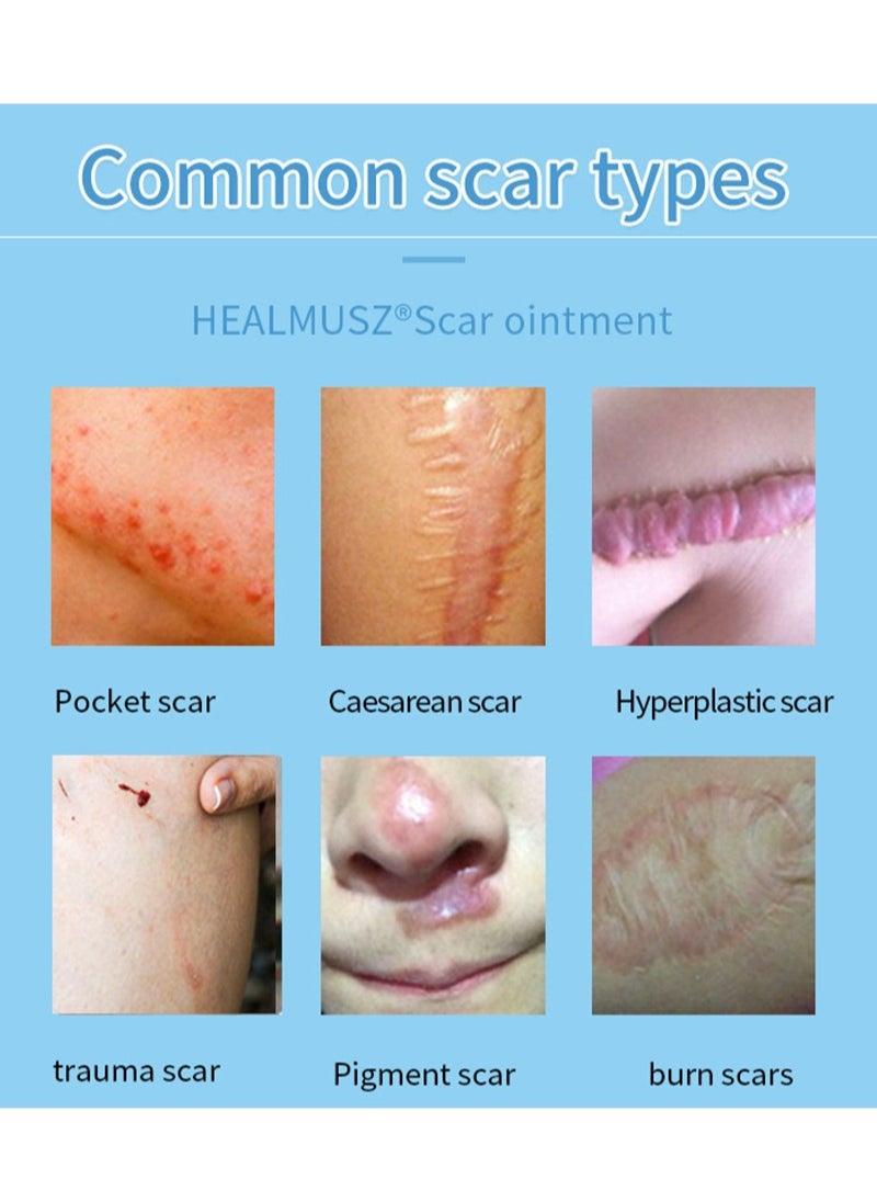 HEALMUSZ - Scar Treatment,Scar Cream,Lump Removal, Effective Scar Removal Cream for Acne Scars, Burn Scars, C-Section Scars, Stretch Marks and Surgical Scars - Image 1