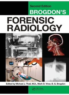 Brogdon's Forensic Radiology - pzsku/Z30FD250191D9F01762F4Z/45/_/1740557241/ef0b5c24-d51d-4b57-95df-27bc51b0d3ff