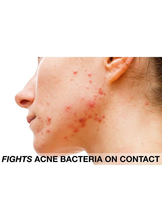 Beauty Facial Extreme - Benzoyl Peroxide 10% Severe Acne Cleanser Clinically Proven Wash To Fight Acne Bacteria On Contact For Cystic Breakouts Oily Skin Clogged Pores Blackhead & Whitehead Pimples For Face & Body. - Image 1