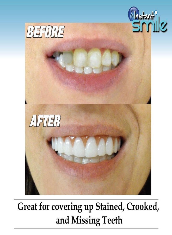إنستانت سمايل عدسات لاصقة Instant Smile Comfort Fit Flex ذات اللون الأبيض الناصع - بها بعض العيوب الطفيفة - مع كيسين إضافيين لتثبيت العدسات. مقاس واحد يناسب معظم الأشخاص. - Image 2