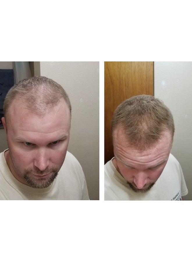 كابوكي كونسيلر لتساقط الشعر. يجعل الشعر الرقيق يبدو أكثر كثافة 10 مرات على الفور. يزيل البقع الصلعاء والشعر الخفيف (30 جم، كمية تكفي 90 يومًا). البني الفاتح - Image 5