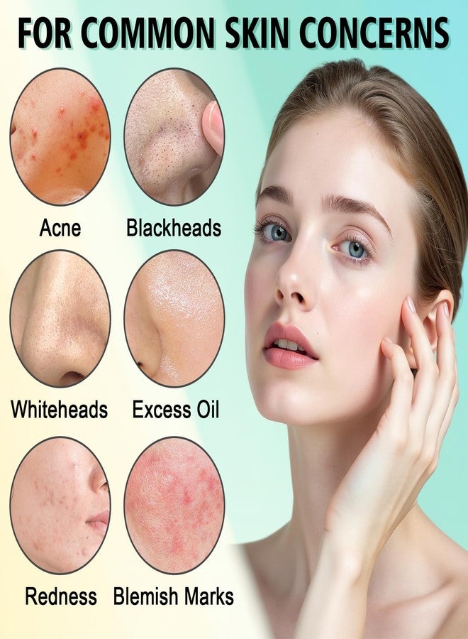 HORSEFISH TOOL Acne Treatment for Face, Acne Cream, Pimple Cream Suitable for All Skin, Blemish Care Cream for Face and Body, Gentle Daily Skin Care for Oily & Blemish-Prone Skin, Helps Improve Skin Appearance - Image 5