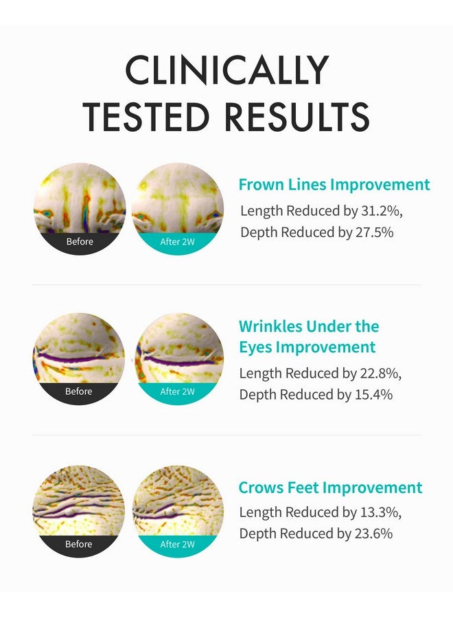 REJURAN® Intensive Eye Cream, c-PDRN® - Fast-Acting Eye Treatment for Wrinkles, Lifting, and Dark Circles. Instant Hydration and Visible Revitalization. Korean Skin Care (0.67 fl oz) - Image 3