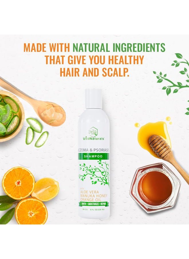 Wild Naturals Psoriasis Shampoo for Scalp Care - Anti Dandruff and Dry Scalp Shampoo - Gentle Itchy Scalp Shampoo - Hydrating Scalp Psoriasis Shampoo for Itchy Scalp Treatment - Anti Dandruff and Dry Scalp Shampoo - Image 5
