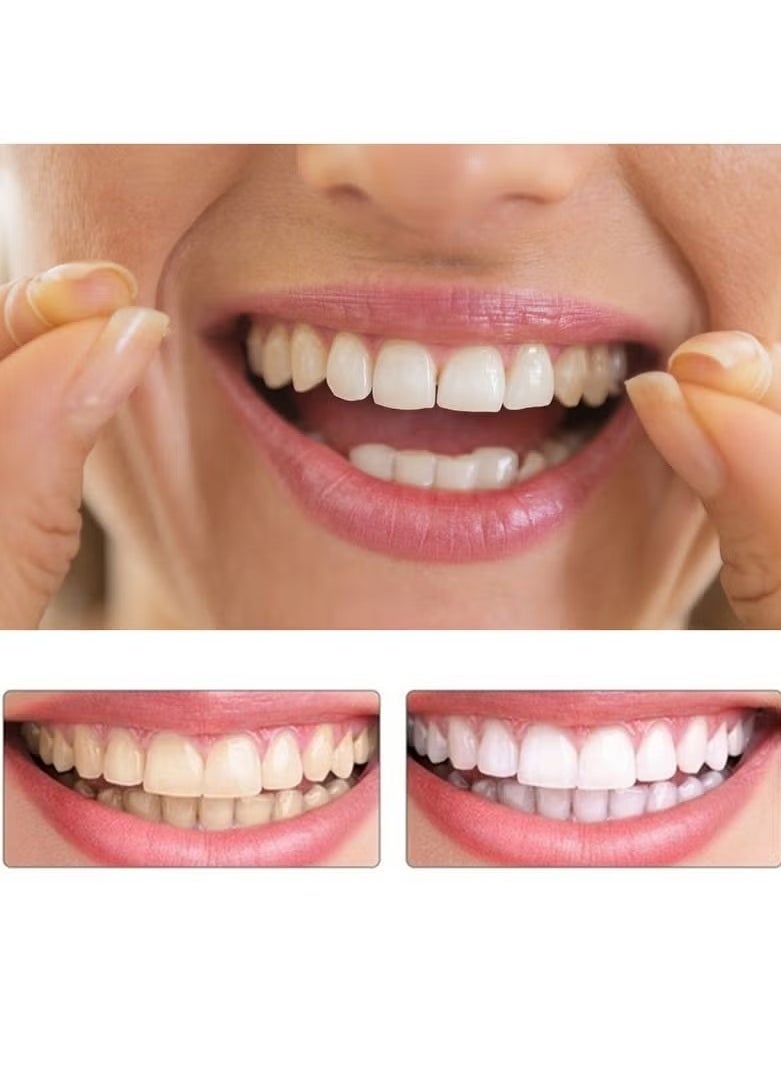 Generic Teeth Veneers Anti-true Braces Snap On Smile Teeth Whitening Denture Teeth Comfortable Veneer Cover Teeth  - Image 4
