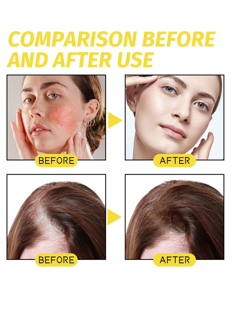 lakerain Black Seed Oil for Hair Growth 100% Pure and Natural Organic Black Seed Oil for Hair Growth and Skin Care Moisturize Hair and Skin Repair Dry and Damaged Hair Strengthen Hair Oil 30ml - Image 4