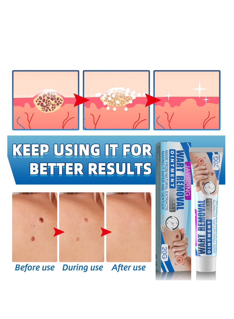 Jaysuing Skin Tag Wart Removal Ointment 20g  - Image 3