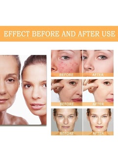 Yuwell The Ordinary  Glycolic Acid 7 Percent Toning Solution Clear 240ml 240ml  - Image 5