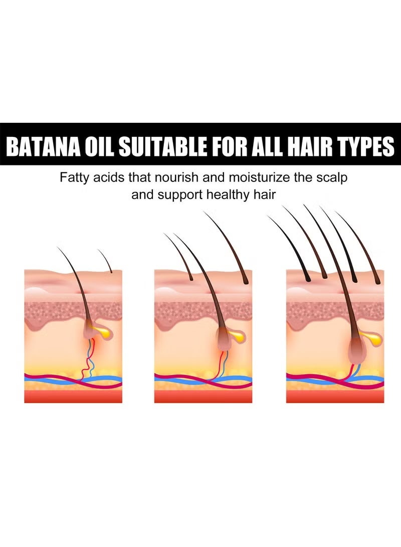 EELHOE Batana Oil for Hair Growth Batana Oil - Batana Oil Organic for Healthy Hair - Repair Damaged Hair, Nourishes Thin Hair Scalp Skin and Loss Hair Growth Fir for All Hair Types - 30 ml - Image 5