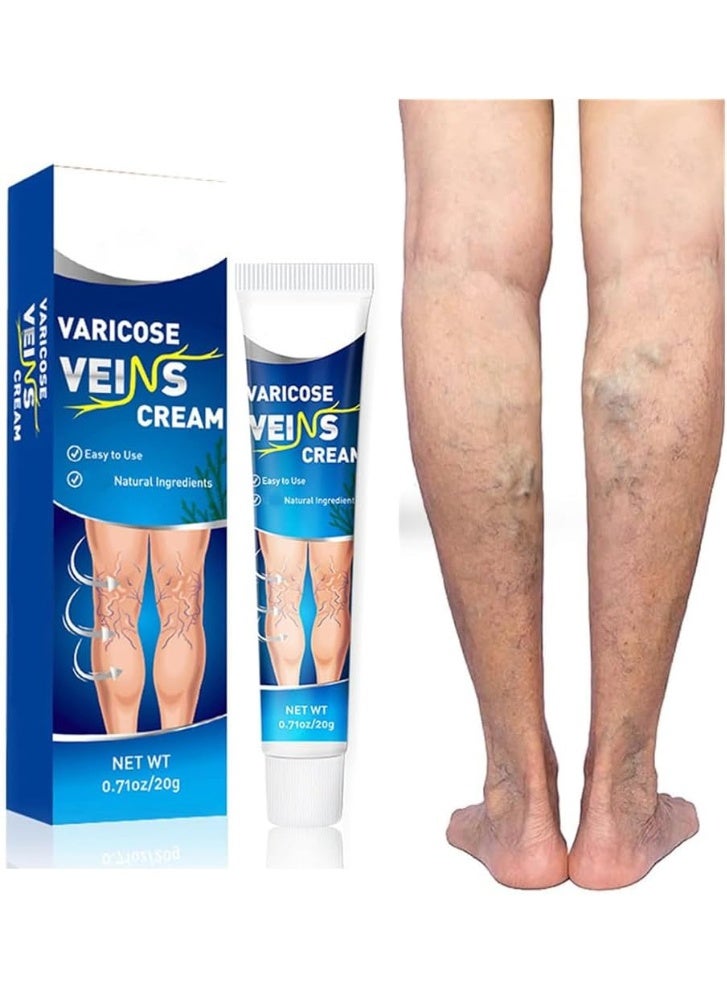 Sumifun Varicose Vein Cream For Legs, Improves Blood-Circulation, Reduces Spider Veins And Heaviness, Improve Blood-Circulation, Tired And Heavy Legs, 20G - Image 1