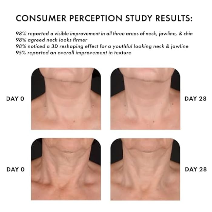 Whish Neck Firming Cream with Bakuchiol - 3D Reshaping Effect for Neck, Jawline & Chin - 3.4oz - Image 2