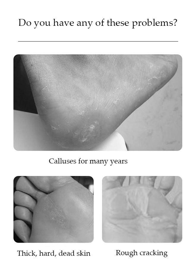 إسكدنيا مبرد القدم الإلكتروني الاحترافي لإزالة الجلد الميت والمتشقق (أزرق) - Image 4