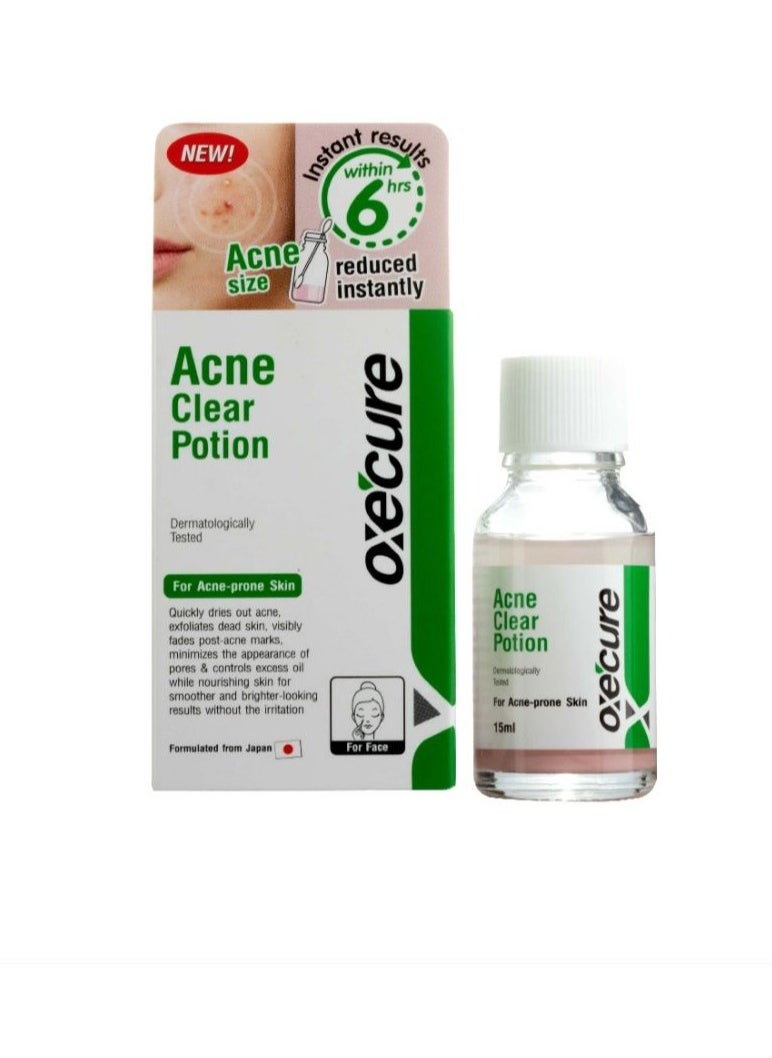 oxe cure - Acne Clear Potion For acne-prone Skin 15ml - Image 1
