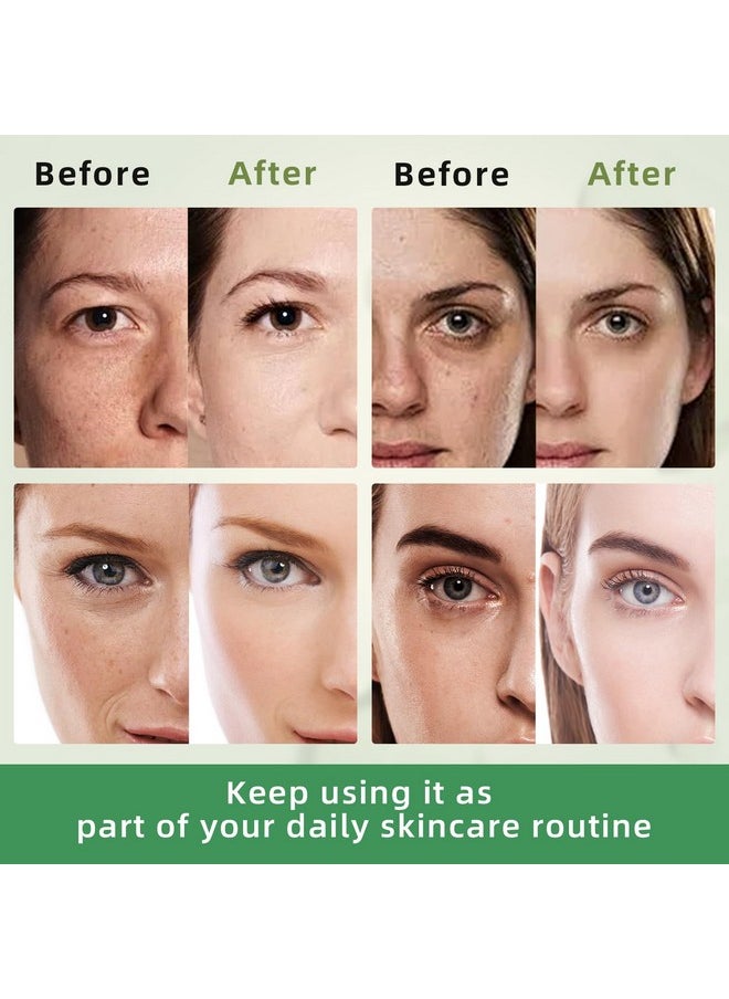 Inlifay Dark Spot Remover For Face With Roller Dark Spot Corrector For Face Fading Sun Spot Age Spot Melasma  - Image 3