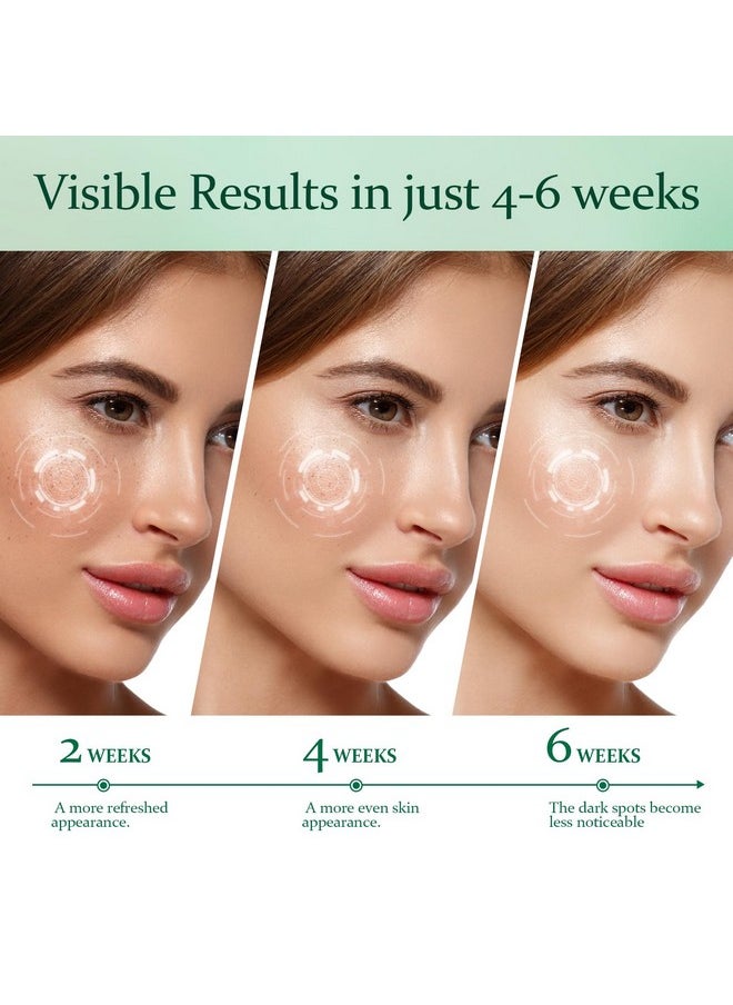 Inlifay Dark Spot Remover For Face With Roller Dark Spot Corrector For Face Fading Sun Spot Age Spot Melasma  - Image 4