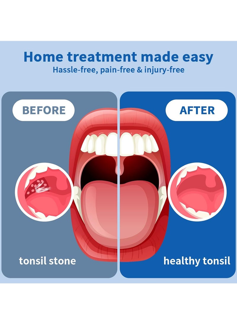 Ru syanl Tonsil Stone Removal Kit Tonsil Stone Remover Vacuum with Built-in Blue Light Rechargeable Tonsil Stone Remover for Bad Breath  - Image 4