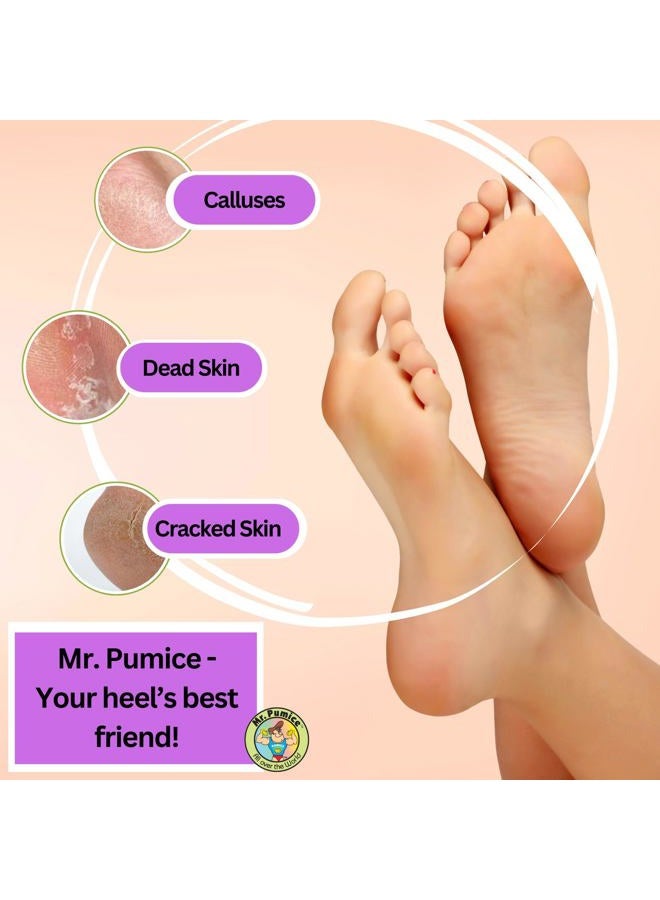Mr. Pumice Purple PUMI Bar, Extra-Coarse Callus Remover, Pedicure Stone & Ped File Scrubber for Smooth Feet and Heels, 6 Pack - Image 3