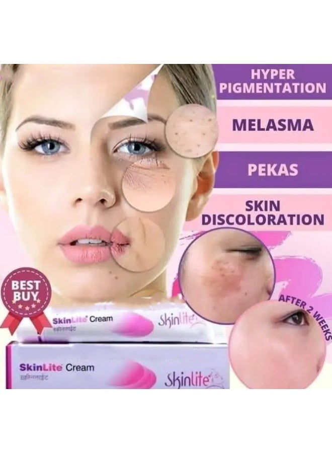 Skinlite Cream for Hyperpigmentation and Dark Spots Removal 25g Each -2 pcs - Image 3