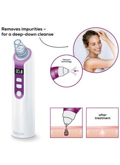 Beurer Power Deep Pore Cleanser | Fc41 | Premium Facial Cleansing Tools  - Image 5