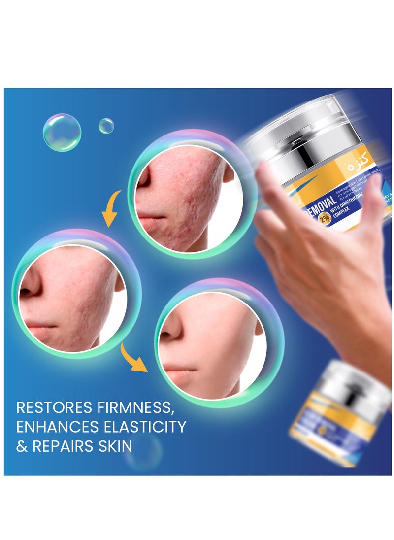 Kanza - Scar And Stretch Mark Removal Cream 50ml For with Dimethicone Complex Added 100% Retinol Free Scar From Damaged Skin & New + Old Scar Removal Treatment Natural Skin Repairing Factors Unisex - Image 1