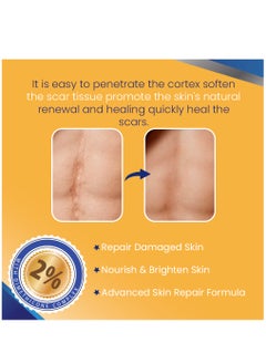 Scar And Stretch Mark Removal Cream 50ml For with Dimethicone Complex Added 100% Retinol Free Scar From Damaged Skin & New + Old Scar Removal Treatment Natural Skin Repairing Factors Unisex - pzsku/Z319241759AD3BCC7016CZ/45/_/1696659942/eccc4964-bb66-4101-b80c-02aa093d9e9f