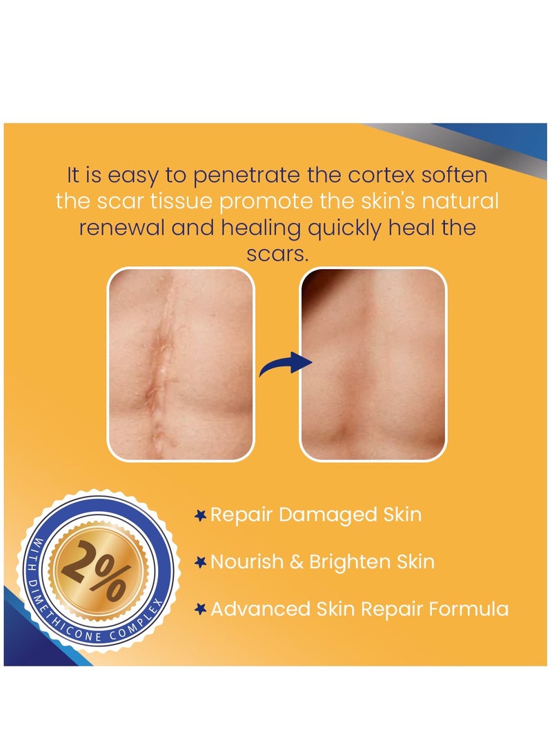 Kanza - Scar And Stretch Mark Removal Cream 50ml For with Dimethicone Complex Added 100% Retinol Free Scar From Damaged Skin & New + Old Scar Removal Treatment Natural Skin Repairing Factors Unisex - Image 1