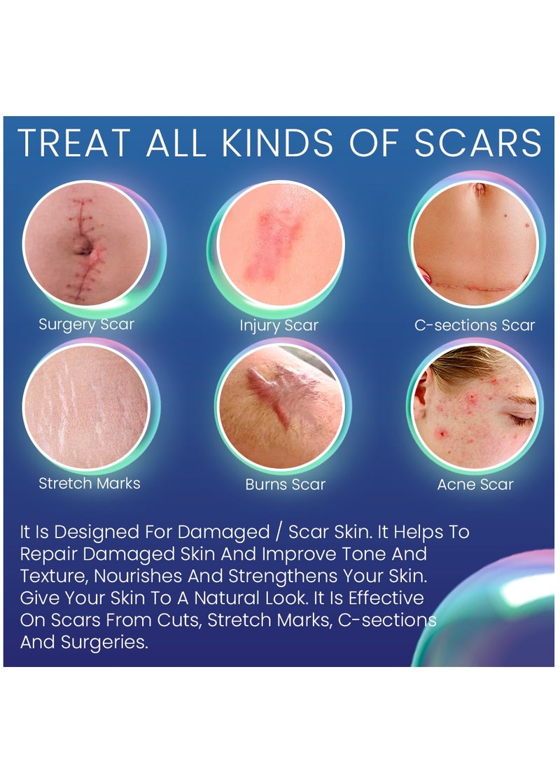 Kanza - Scar And Stretch Mark Removal Cream 50ml For with Dimethicone Complex Added 100% Retinol Free Scar From Damaged Skin & New + Old Scar Removal Treatment Natural Skin Repairing Factors Unisex - Image 1