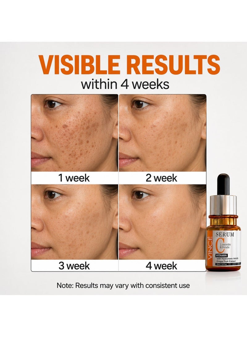 VINCE Vitamin C Serum Deal 2 – Advanced Brightening Formula – Reduces Dark Spots, Sun Damage & Hyperpigmentation, Evens Skin Tone, Smooths Texture & Boosts Youthful Glow – For All Skin Types, 30ml Each - Image 3