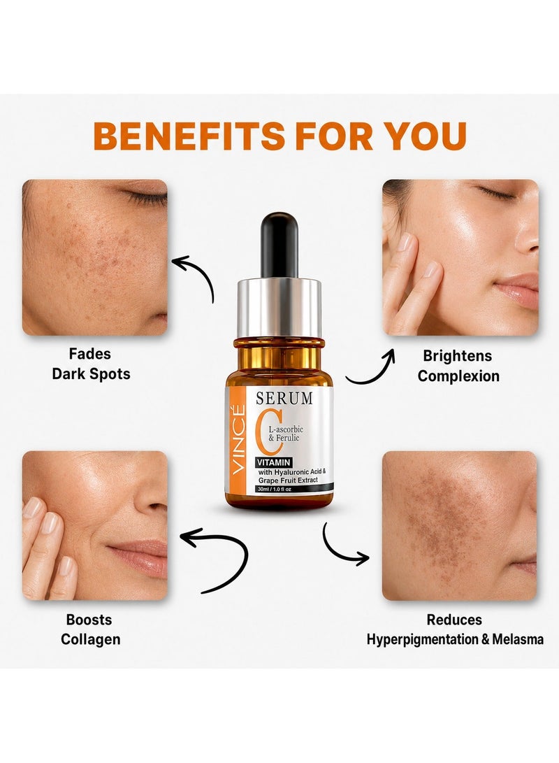 VINCE Vitamin C Serum Deal 2 – Advanced Brightening Formula – Reduces Dark Spots, Sun Damage & Hyperpigmentation, Evens Skin Tone, Smooths Texture & Boosts Youthful Glow – For All Skin Types, 30ml Each - Image 4