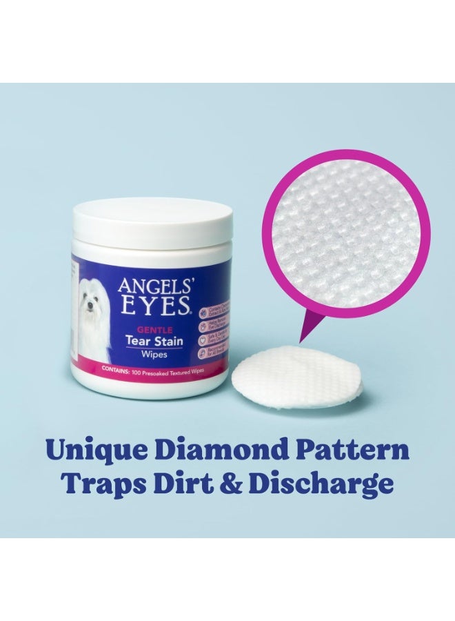 ANGELS' EYES Gentle Tear Stain & Pet Eye Wipes for All Dogs & Cats Textured Grooming Wipes Remove Discharge & Mucus, Reduce Tear Stains, Hypoallergenic with Aloe & Chamomile, 100ct - Image 5