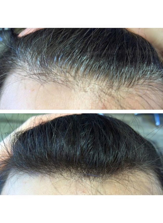 لوريال بروفيسيونال خافي عيوب جذور الشعر هاير تاتش أب - Image 2