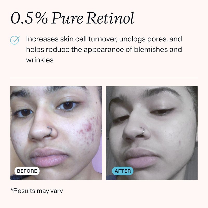 MDacne â€“ Retinol 0.5% and Niacinamide 4% Cream, Reduces Blemishes and Improves Skin Texture without Irritation - Image 3