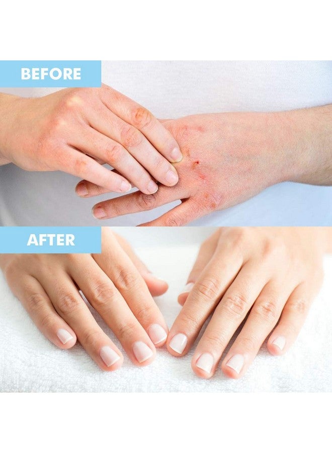 بودي بيور قناع ممتاز لليدين والقدمين | قفازات وجوارب مرطبة من كيرتين | مرطب لليدين الجافة الباهتة والكعب المتشقق وتنعيم الجلد الميت وتقوية الأظافر | علاج خالٍ من المواد الكيميائية للقدمين | (عبوة من 3 قطع) - Image 5