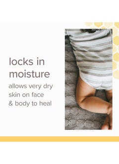Burt's Bees Burt's Bees Baby 100% Natural Origin Multipurpose Healing Ointment, Face & Body Baby Ointment - 7.5 Ounce Tub - Pack of 3  - Image 2