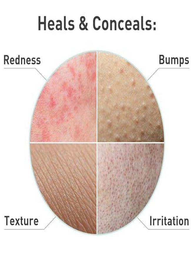 PROcure Rosacare Medicated Redness Reduction CC Face Cream, Hyaluronic Hydrogel for Rosacea Symptoms, 2 Count - Image 3