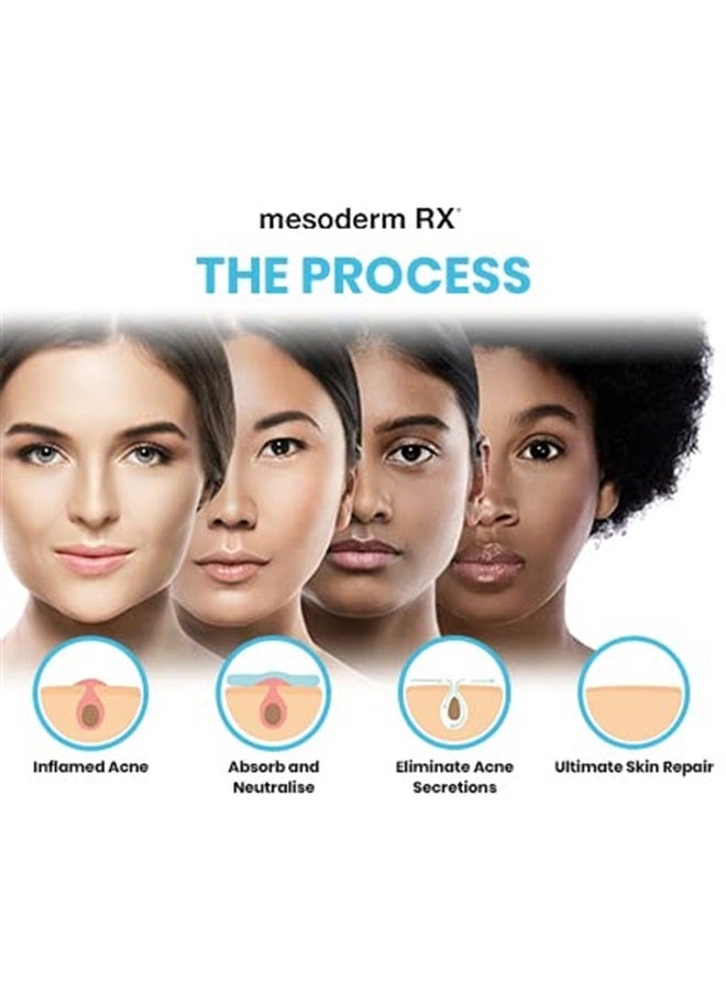 Maximum Slim Mesoderm RX Acne Patch - Hydrocolloid Acne Pimple Patch for Zits and Blemishes, Spot Treatment Stickers for Face and Skin, Vegan and Cruelty Free (72 Count) - Image 4