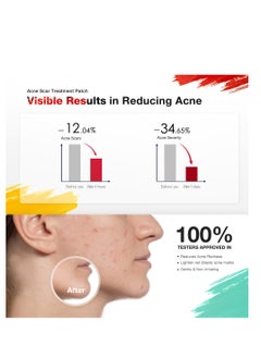 JOVS Jovs AcneBye Smart Acne Patch & Acne Mark Patch – Blue & Red Light Therapy, Salicylic Acid, Centella Asiatica, Fast Acne Removal, Fades Acne Scars, Hydrocolloid, Clinically Tested  - Image 5